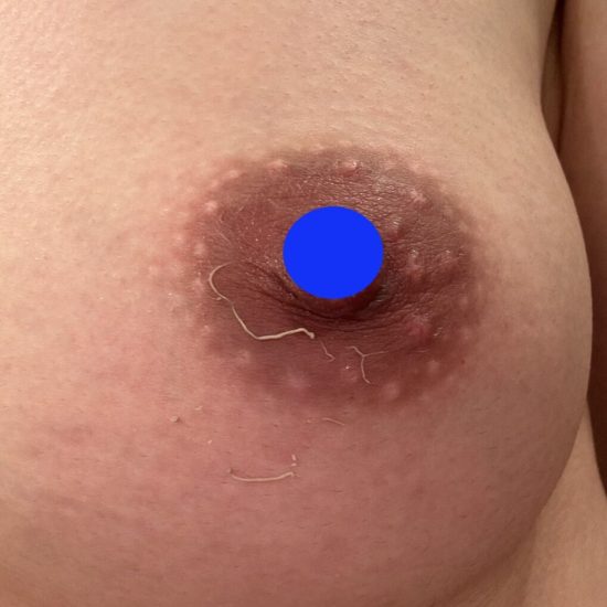 17日後のコピー