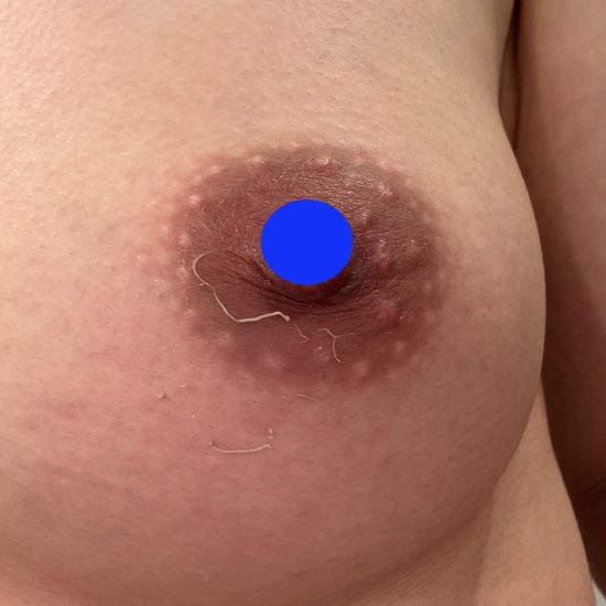 17日後のコピー