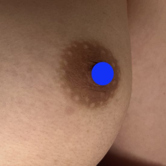 1ビフォー★のコピー