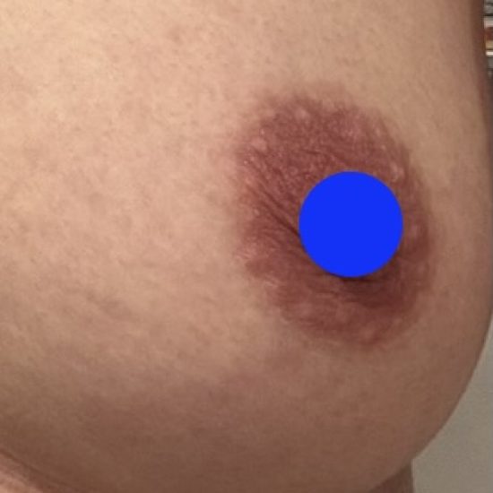 28日後(4週間)のコピー