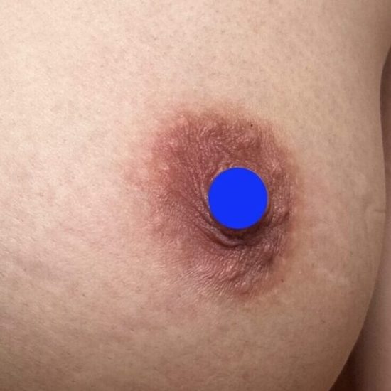 32日後(1ヶ月)のコピー