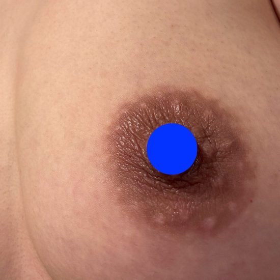 5日後ピカピカ感★のコピー